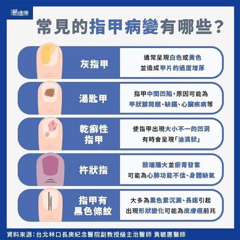 手長黑斑|【手長黑斑】手長黑斑恐是癌症徵兆！教你輕鬆辨別與5大消除黑。